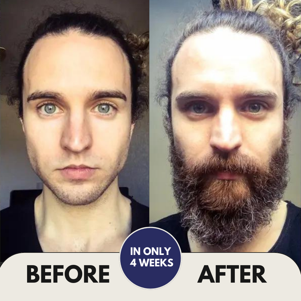 Hair & Beard Growth Activator