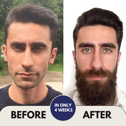 Hair & Beard Growth Activator